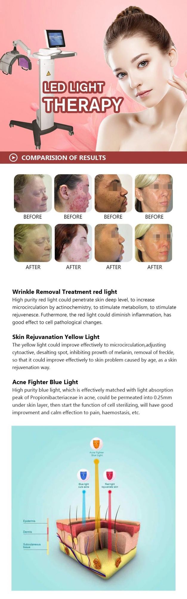 LED Photo Skin Rejuvenation Omega Lifting Machine Photon Therapy