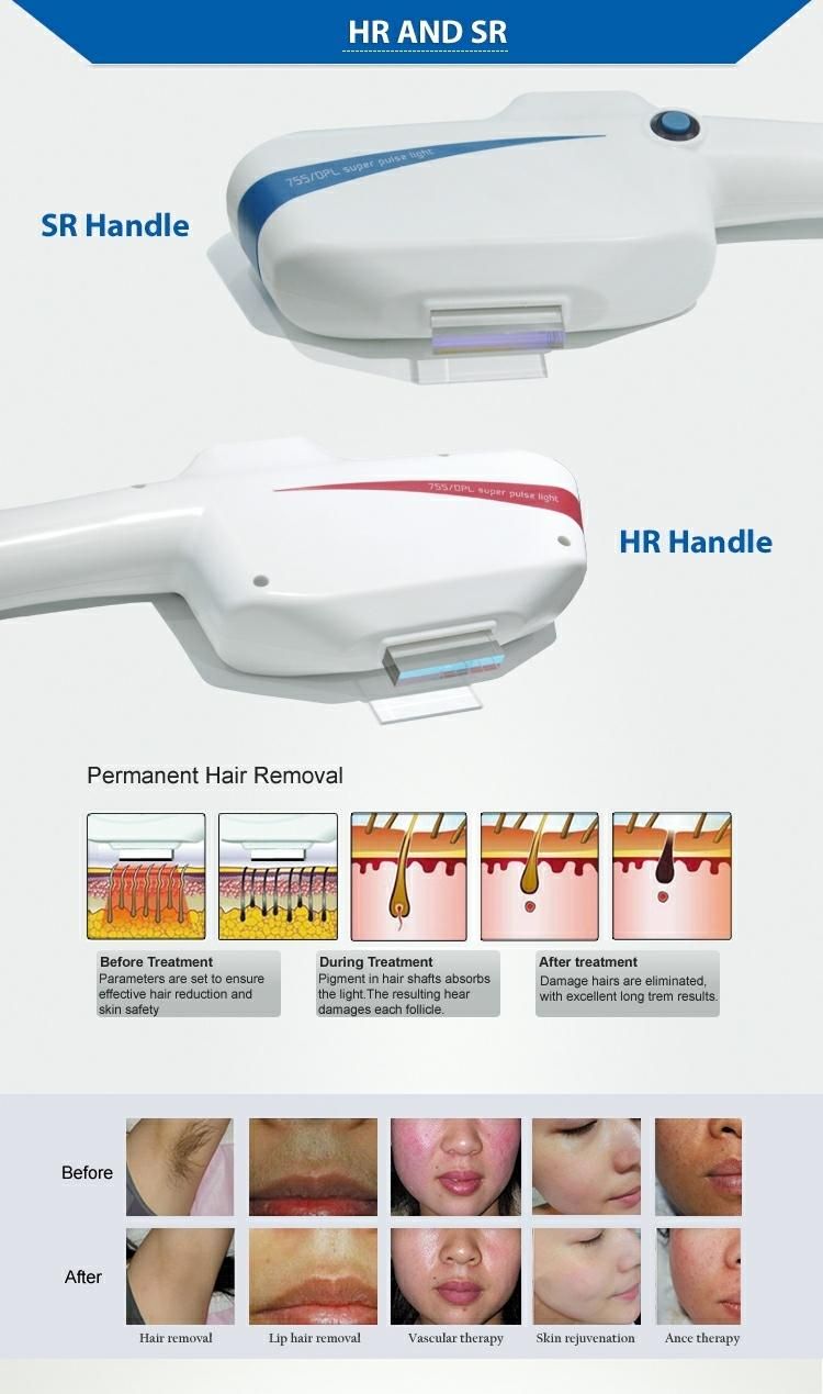 Permanent RF Opt Shr IPL Laser Hair Removal Machine Facial SPA