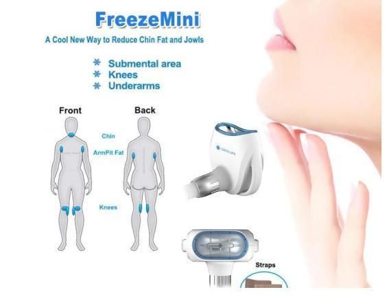 Coolmax 360 Series Cryo Face Body RF Fat Freeze Cryolipolysis 360 Criolipolisis with Cavitation Lipolaser Criolipolisis Machine