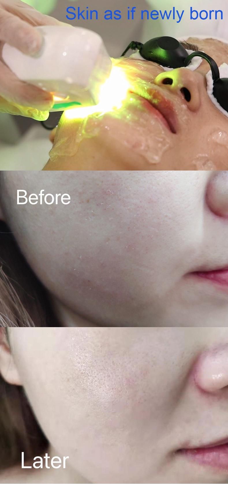 2022 New Beauty Equipment Skin Rejuvenation Oil Control Skin Whitening Shrink Pores Near Infrared Light Wave Multifunctional Near Infrared
