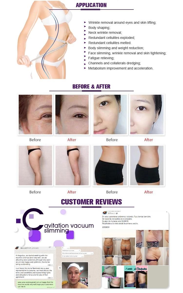 Ce Authentication Facial Beauty RF Microneedle Rejuvenation Multipolar Radio Frequency for Skin Care