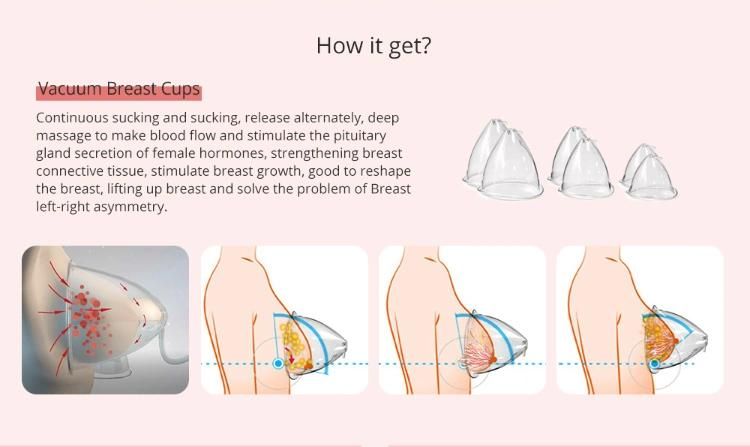 Konmison Upgrade Vacuum Cupping Therapy Breast Enlargement Butt Lift Machine