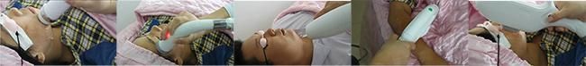 Diode Permanent Laser Hair Removal Machine
