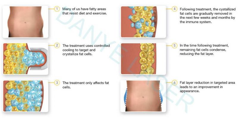 Cryo RF Vacuum Cavitation System Body Remodeling Equipment