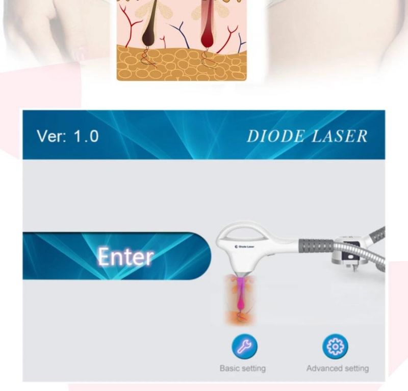 Diode Laser Hair Removal Beauty Equipment