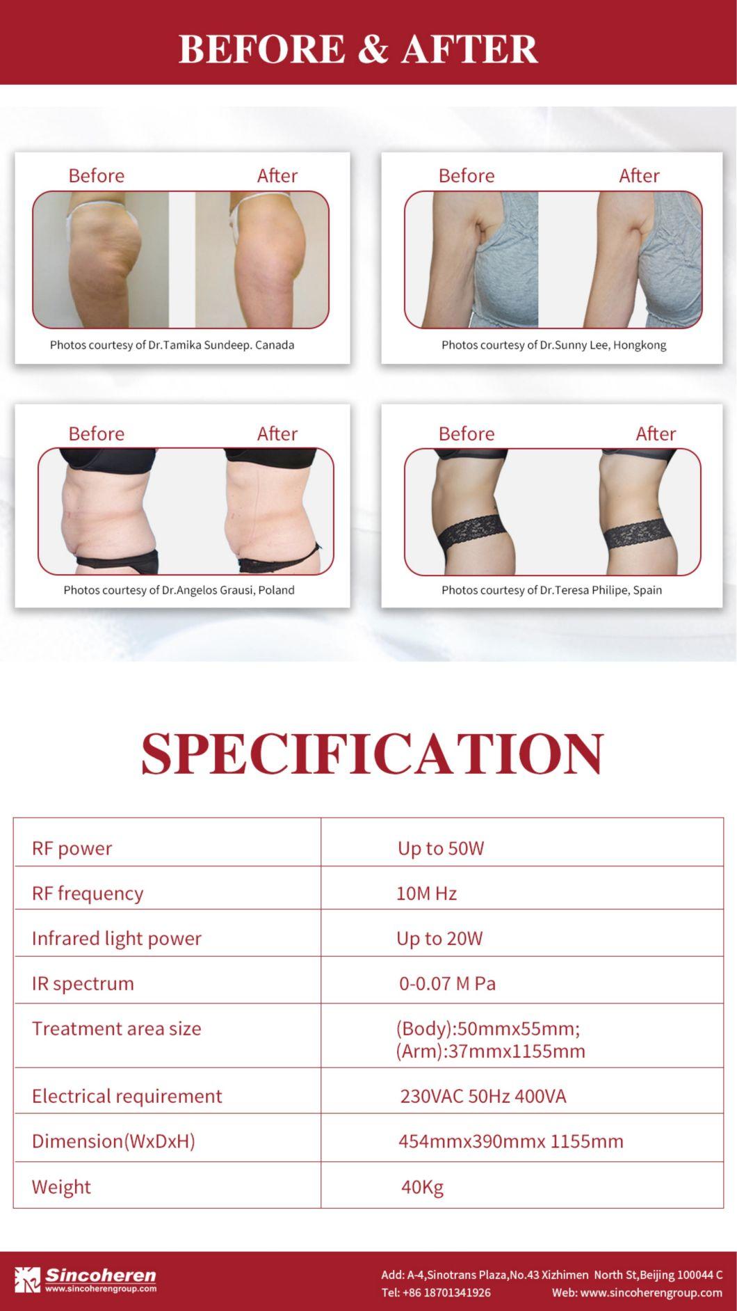 Beijing Sincoheren RF Radio Frequency Body Shape Body Contour Kumashape for Body Slimming Skin Tightening Machine (J)