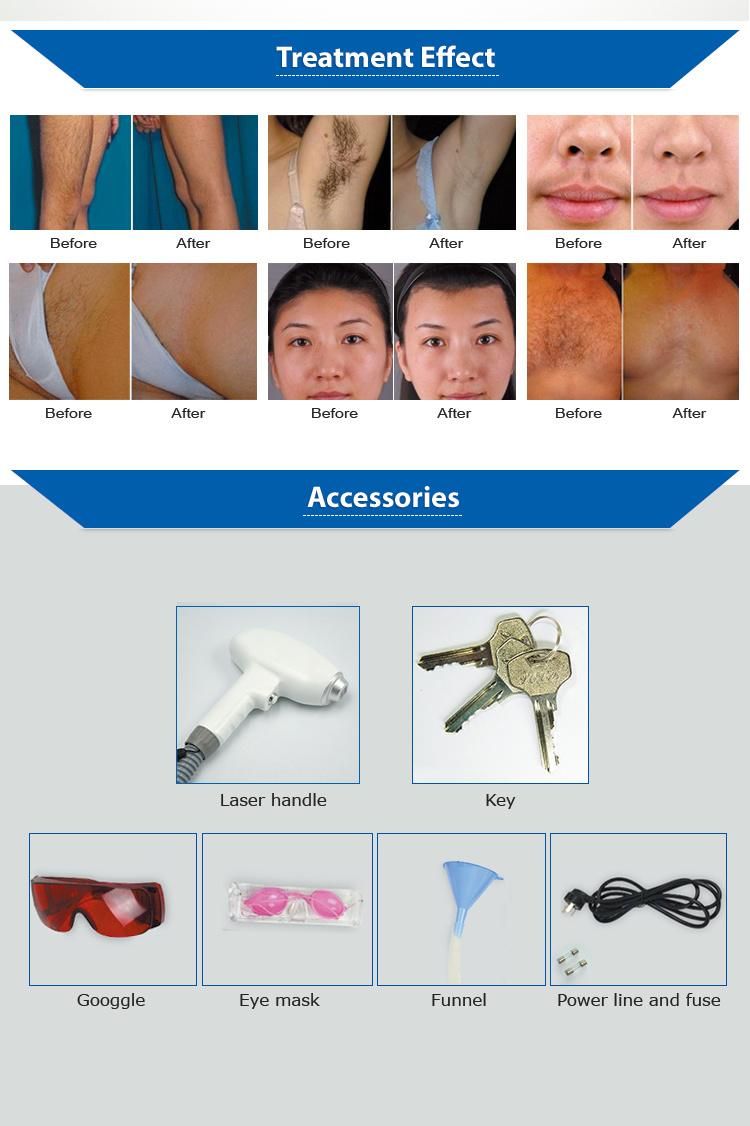 Professional Beauty Machine Diode Laser Hair Removal Machine