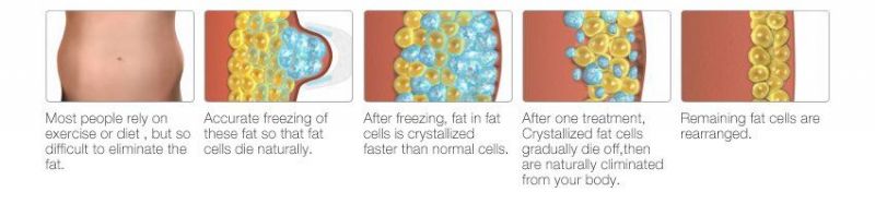 Fat Freezing Weight Loss Home Use Cryolipolysis Machine