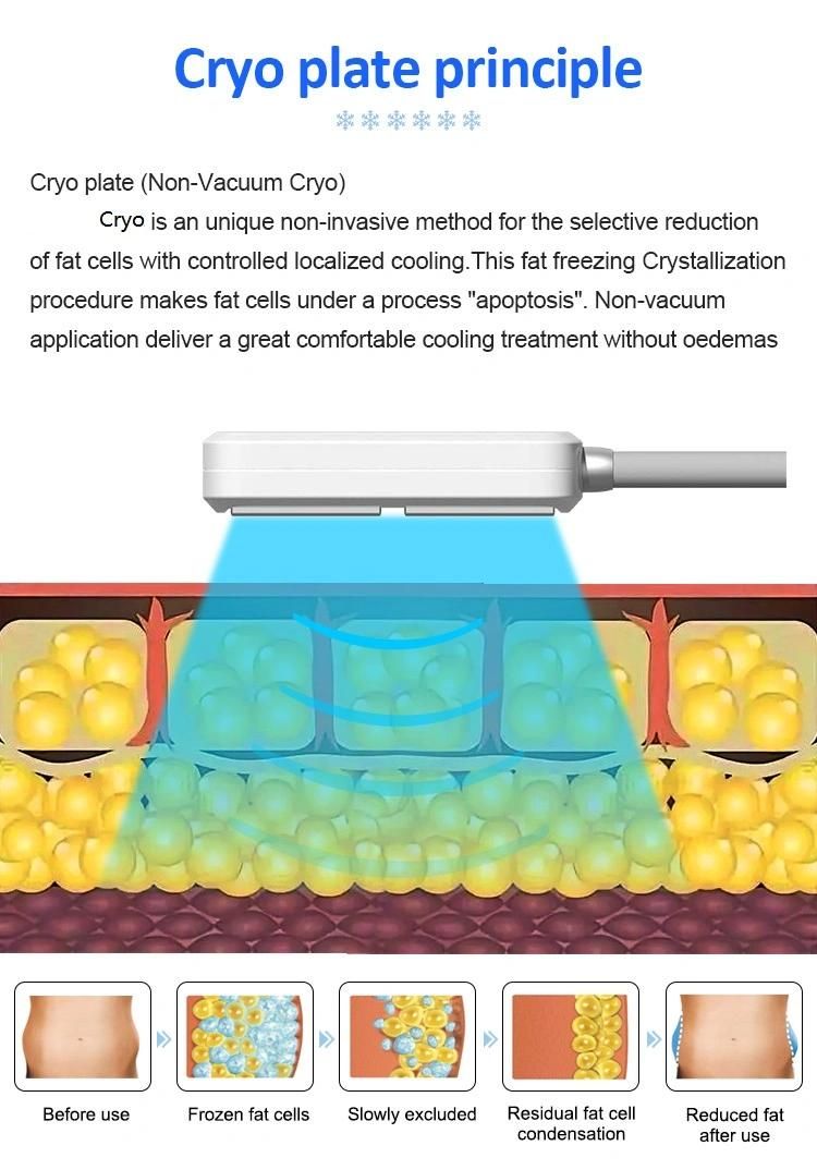 Effective Body Cryolipolysis Pads Cryotherapy Beauty Machine with EMS Slimmming