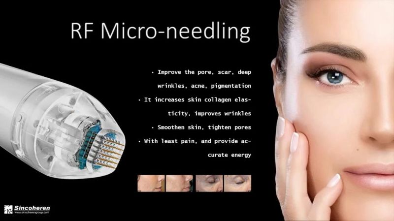 Newest Vertical Microdermabrasion Machine for Skin Tightening and Wrinkle Acne Removal