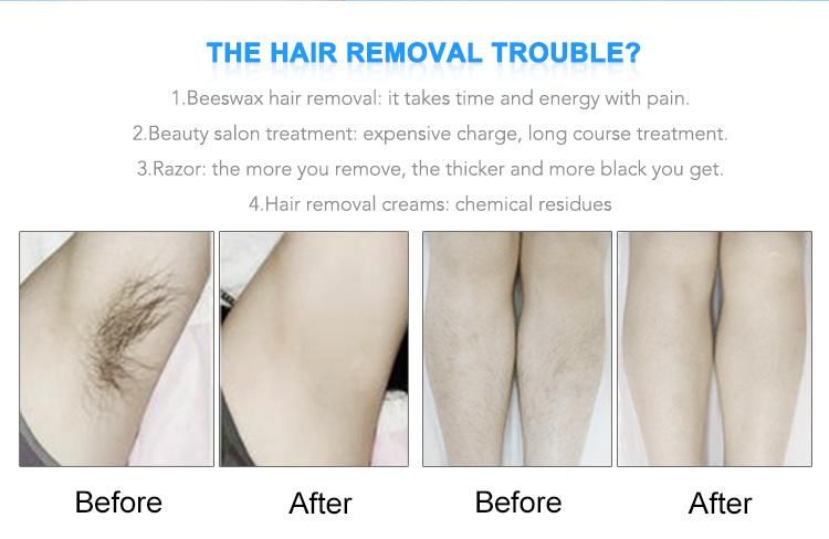 IPL & RF Laser Hair Removal Skin Rejuvenation Beauty Machine