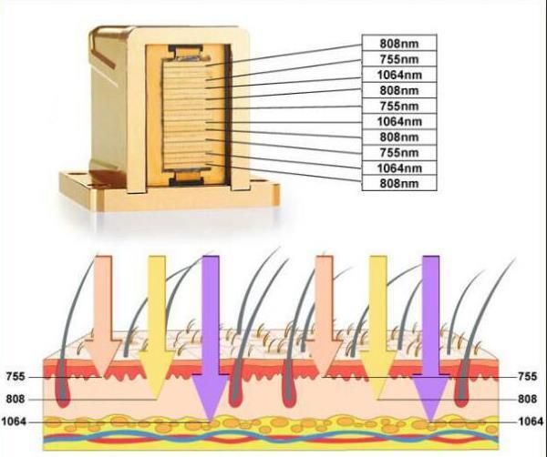 Black Skin 808nm/810nm Armpit Laser Diode Hair Removal