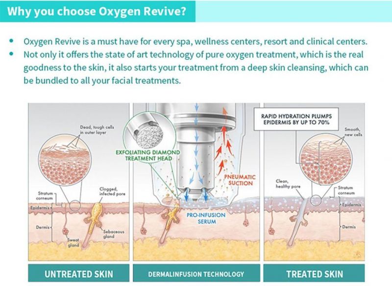 Jo. Sincoheren Multifunctional Oxygen Revive Hydro Deep Cleaning Machine Ultrasonic Skin Peeling for Firming Skin Blackhead Removal
