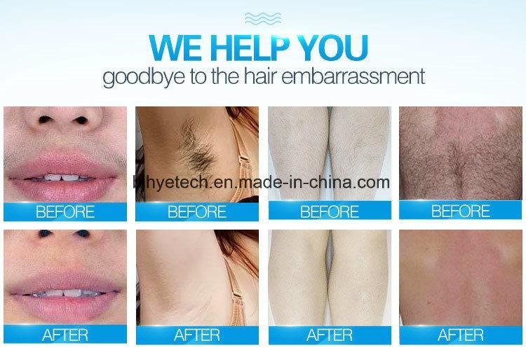 Factory Price Permanent Hair Removal Equipment Painless Laser 808nm Diode Laser Hair Removal