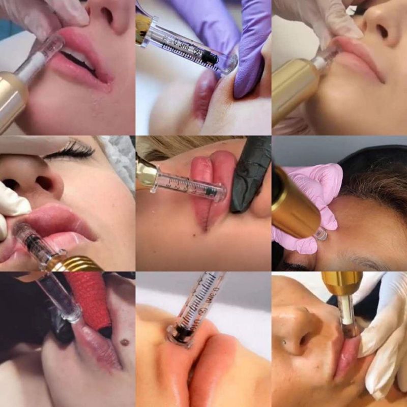 New Products Lip Filler Injections No Needle Mesotherapy Gun