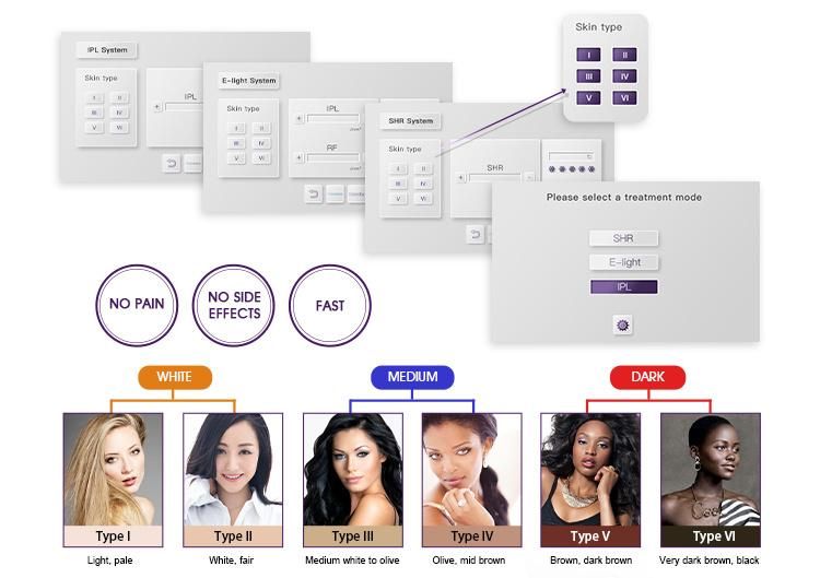 Factory Price IPL Shr Handpiece for E-Light IPL+RF Pigments Removal Skin Care