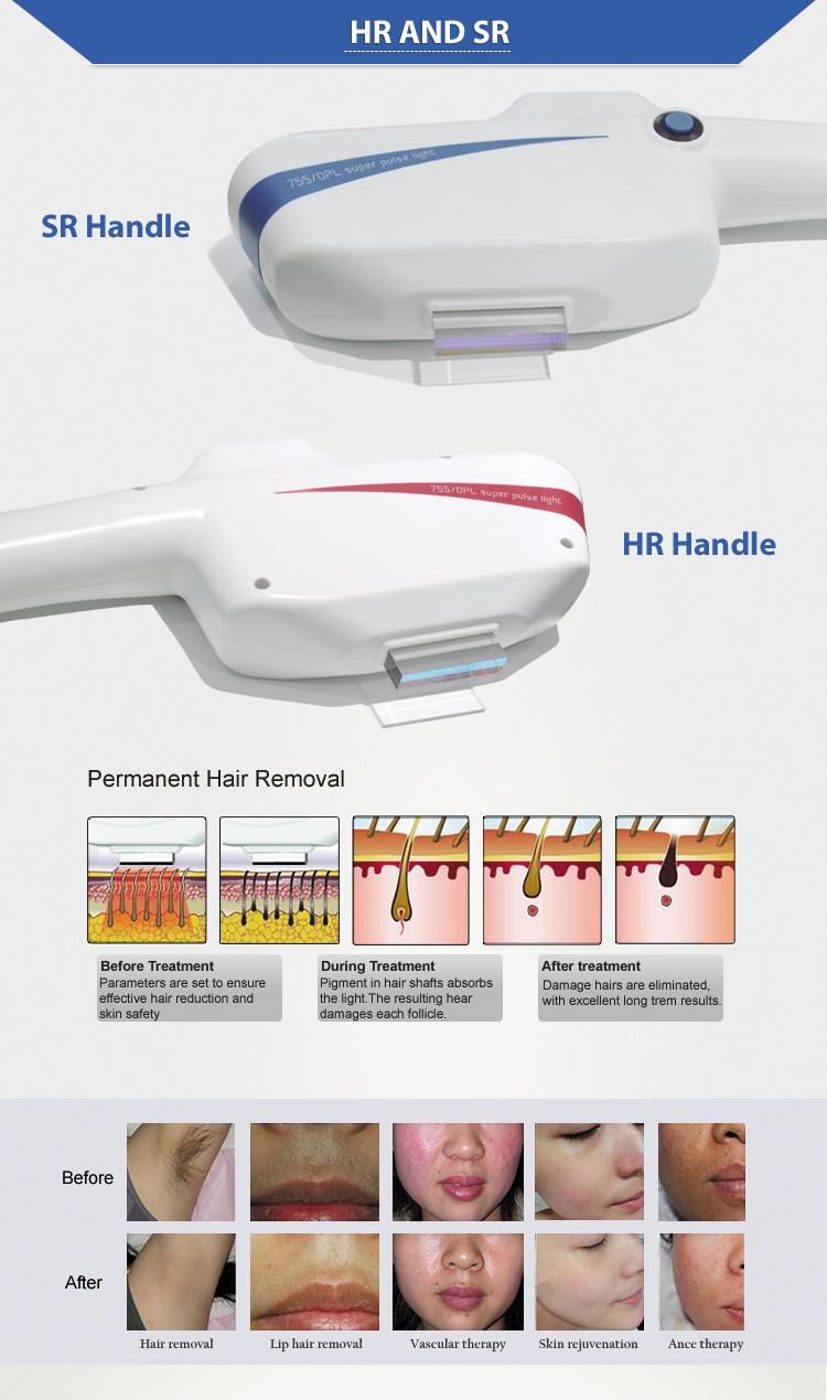 Vertical Double Handle Dpl Machine Hair Removal and Skin Rejuvenation