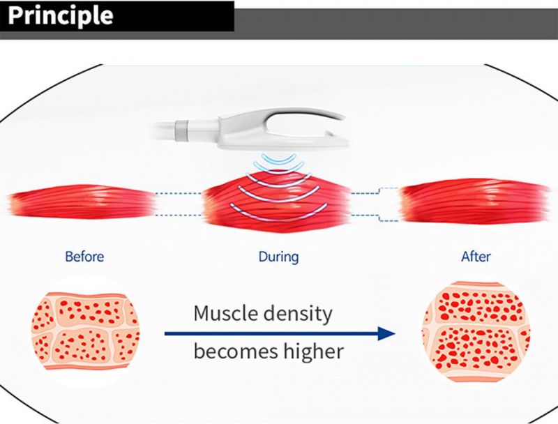 Best Selling Hi-EMT Portable Musle Building Body Slimming Lose Weight Cellusclpt Sinco Emslim Muscle Training Machine