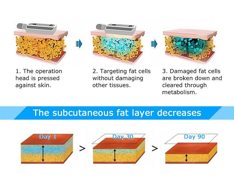 360 Degree Cooling Cryo Cold Lipolysis 8 Handles Cryotherapy Fat Freezing Machine