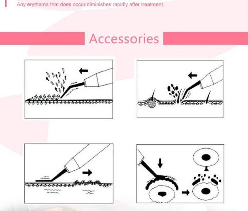 High Frequency Vibration Skin Scruber (BU200)