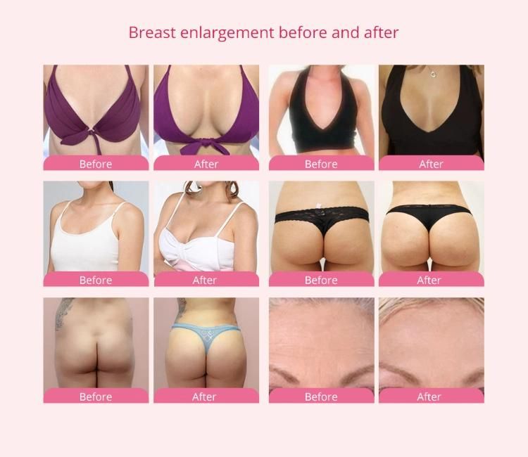 Hot Breast Massage Video Cupping Machine Vacuum Breast Enlargement Machine