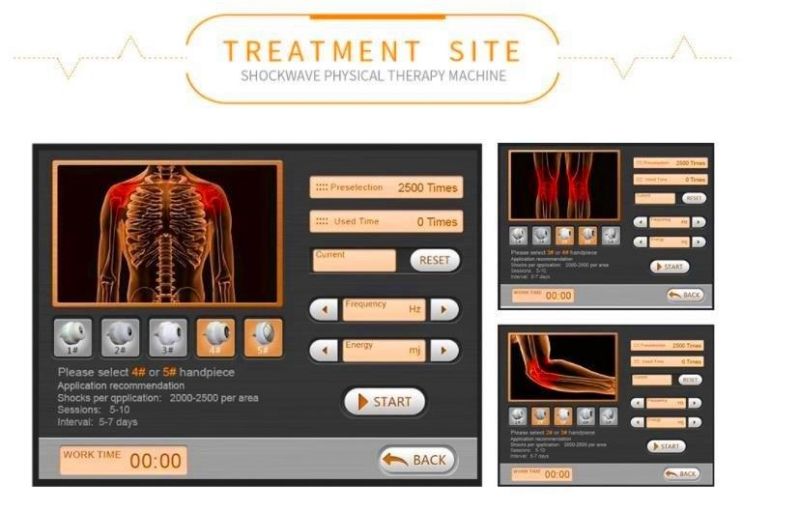 Eswt /Physiotherapy Shockwave Equipment / Electromagnetic Medical Painrelief ED Therapy Shockwave