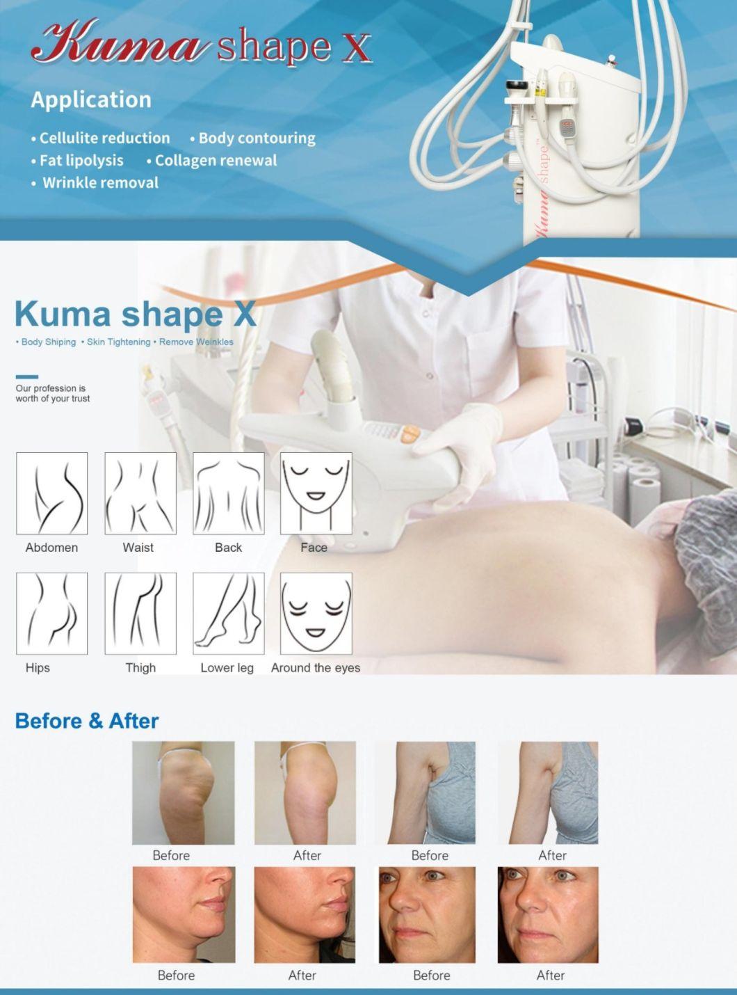 Kuma Shape X Body Contouring Latest Mode 4 Handles Slimming RF Vacuum Infrared Massage Device