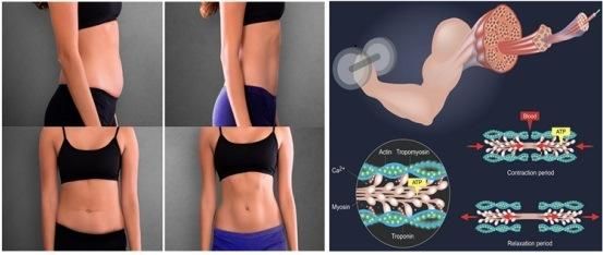 Portable Muscle Building EMS Fat Reduce Slimming Machine