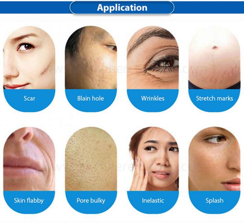 Portable Home RF Micro-Needling Machine for Fast Wrinkle Removal
