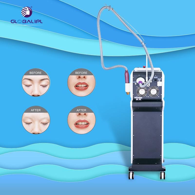 Tattoo Removal Machine YAG Laser for Beauty Salon Machine