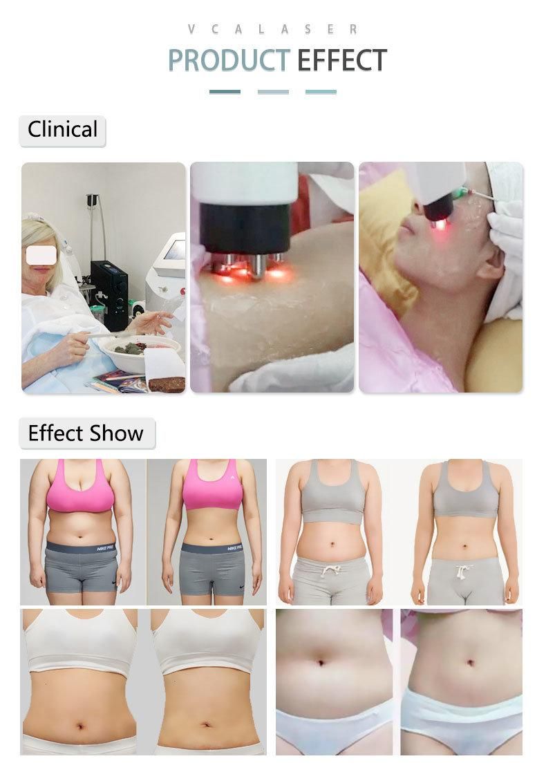 Venus Cavitation Tripolar RF Laser Slimming 4 in 1 Beauty Equipment