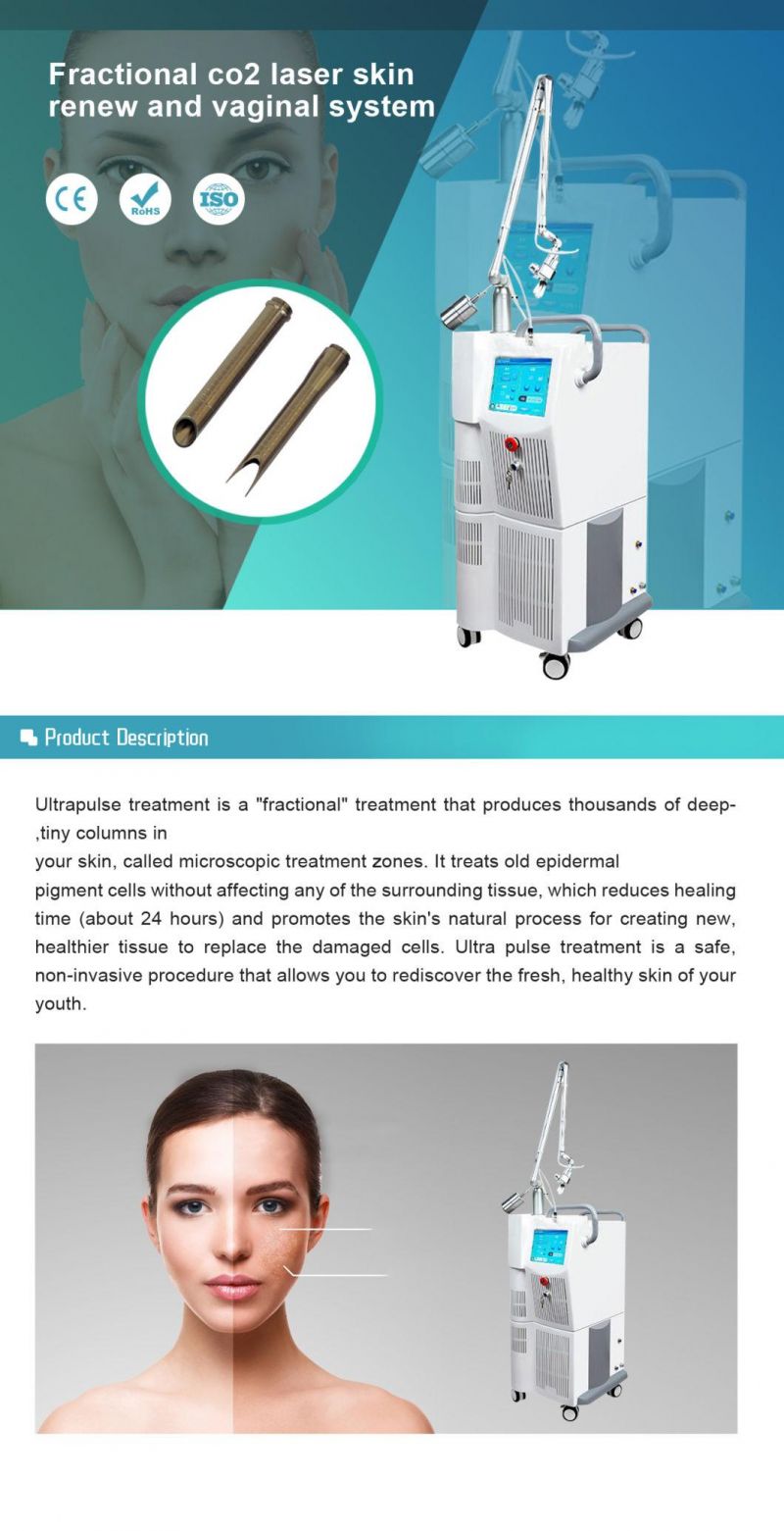 60W Medical Fractional CO2 Laser/CO2 Fractional Laser with Ce Approved