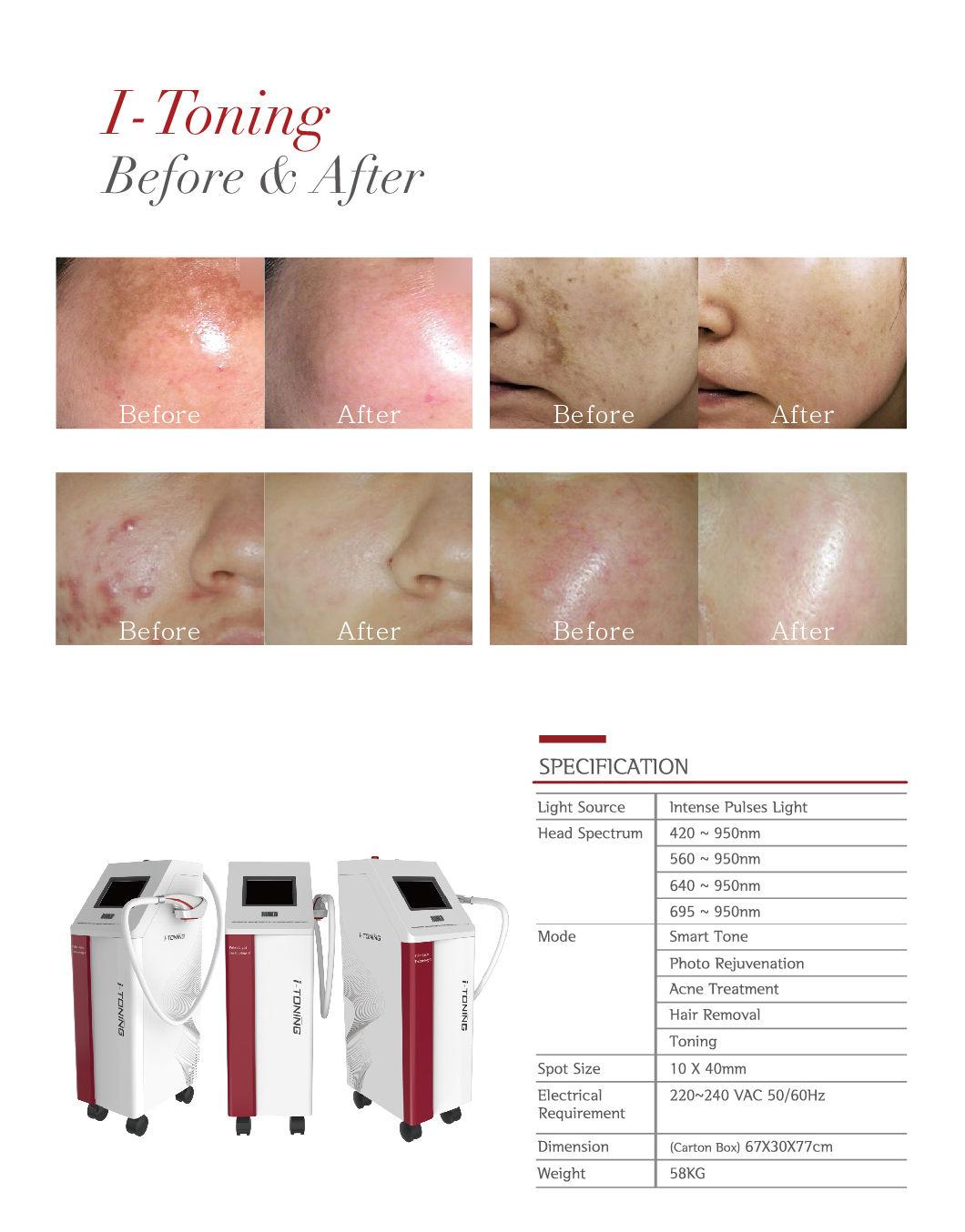 Effective IPL System Beauty Device IPL Hair Removal/ Toning Skin