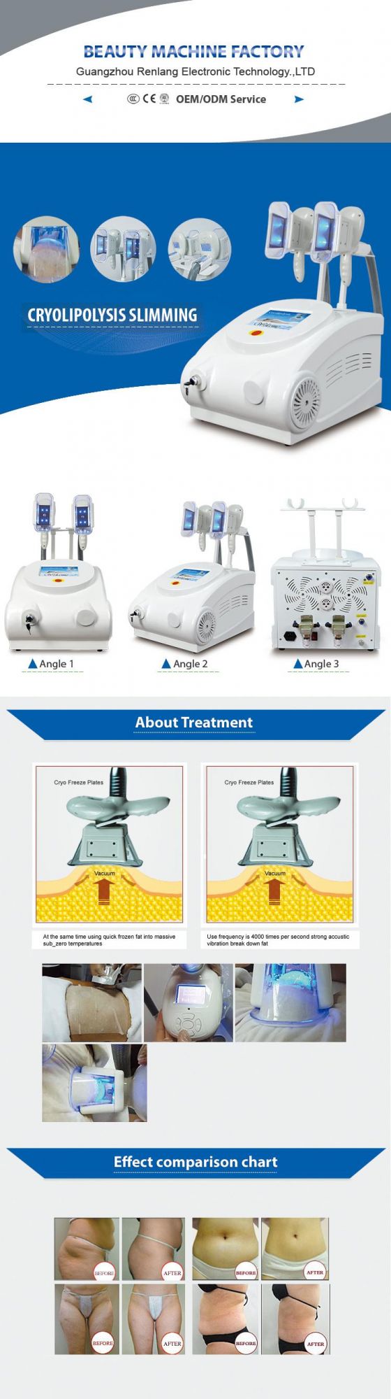 Hot Sale Portable Cryotherapy Vacuum Cryolipolysis Machine with Best Price