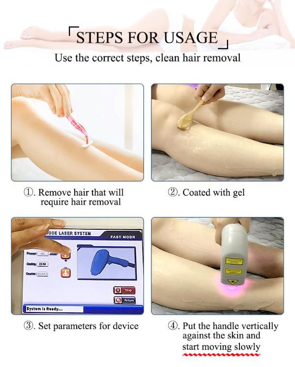 for All Kinds of Skin with Permanent Result Hair Loss 808nm Laser Hair Removal