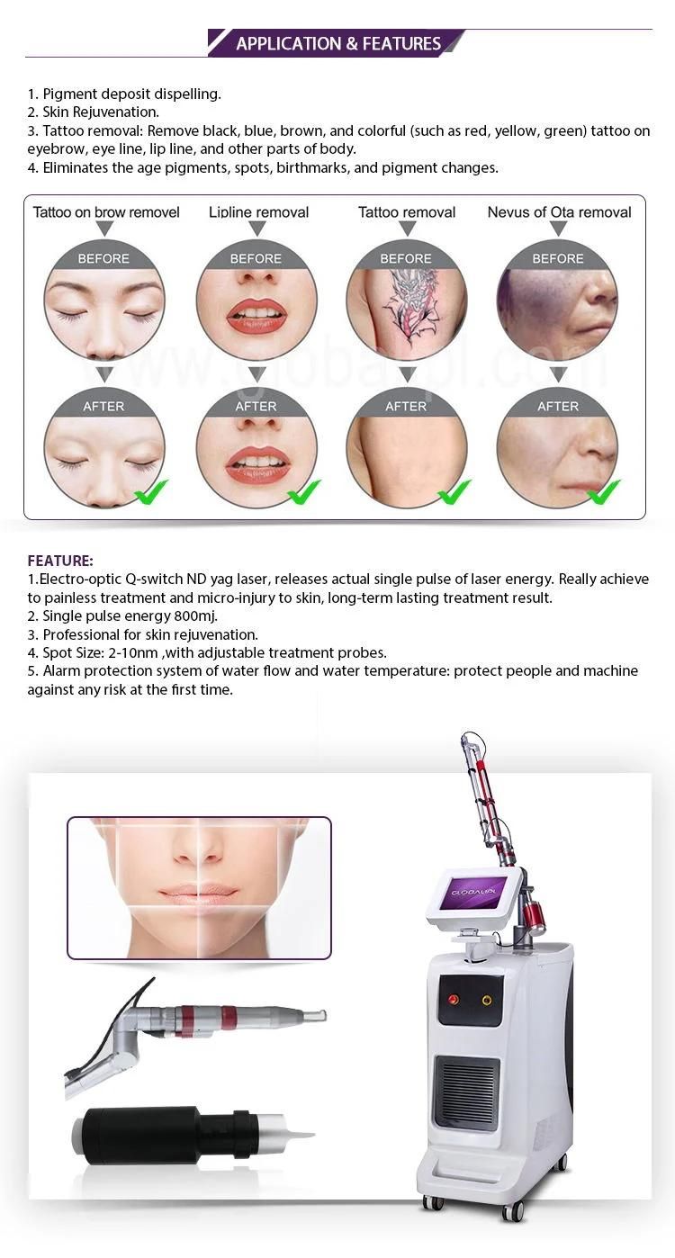 Beijing Globalipl FDA Approved ND YAG Tattoo Removal Laser Machine