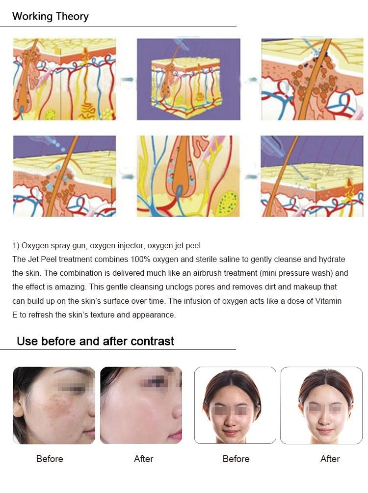 Oxygen Jet Peeling Facial Cleaning Machine with PDT LED Light