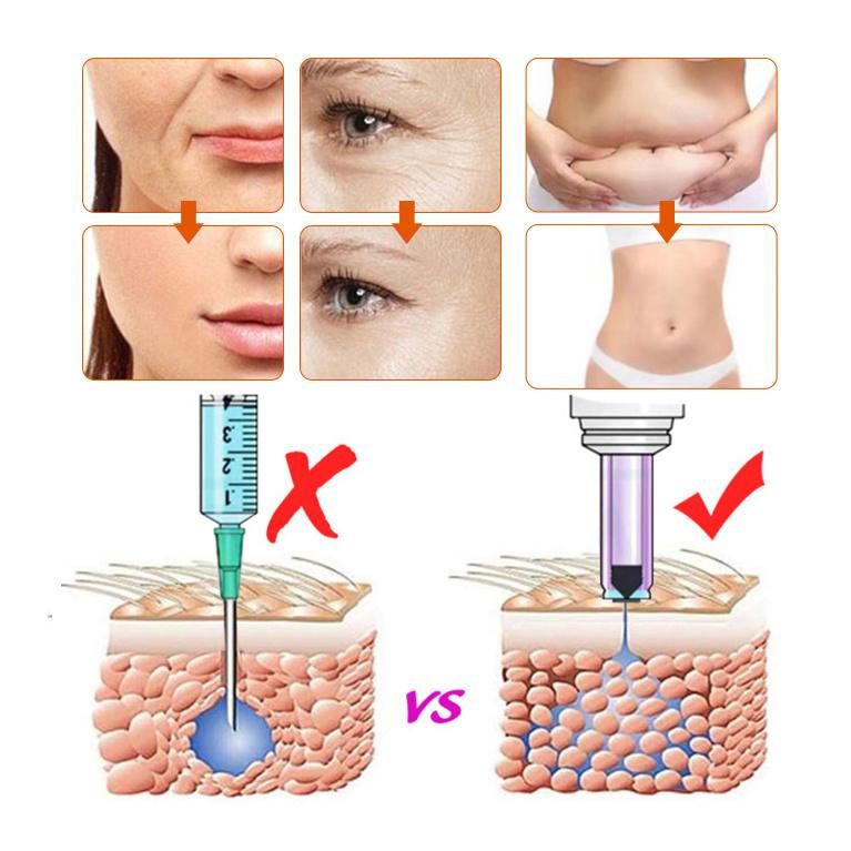 High Quality Hyaluronic Acid Dermal Hydrating Wrinkles Fill Derma Pen