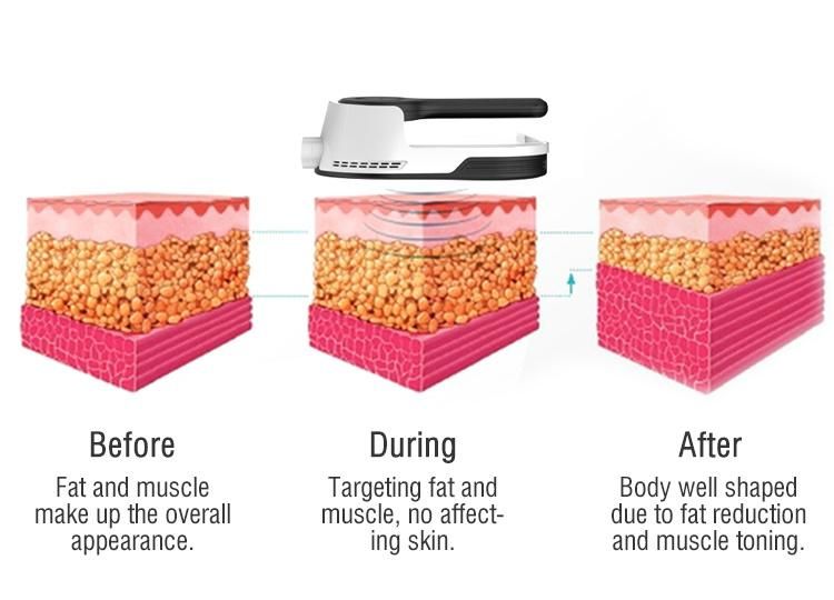 4 Handles 2 in 1 Emslim 360° Fat Freezing Machine