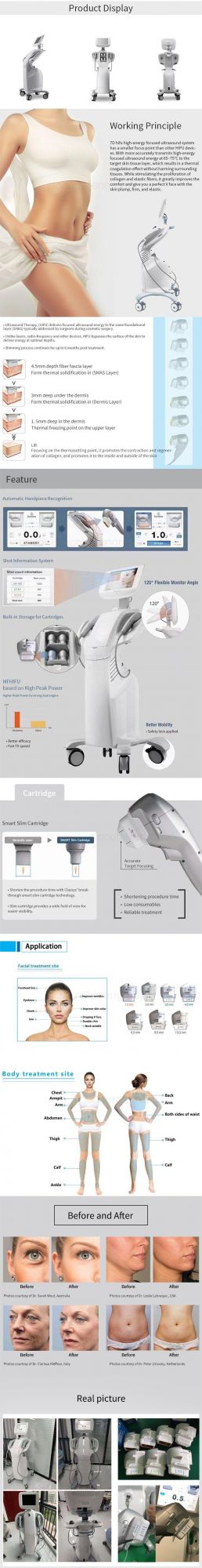 2021 New Technology Mmfu Ultra 7D Former 7D Hifu Machine for Wrinkle Removal Hifu Facical Treatment Machine