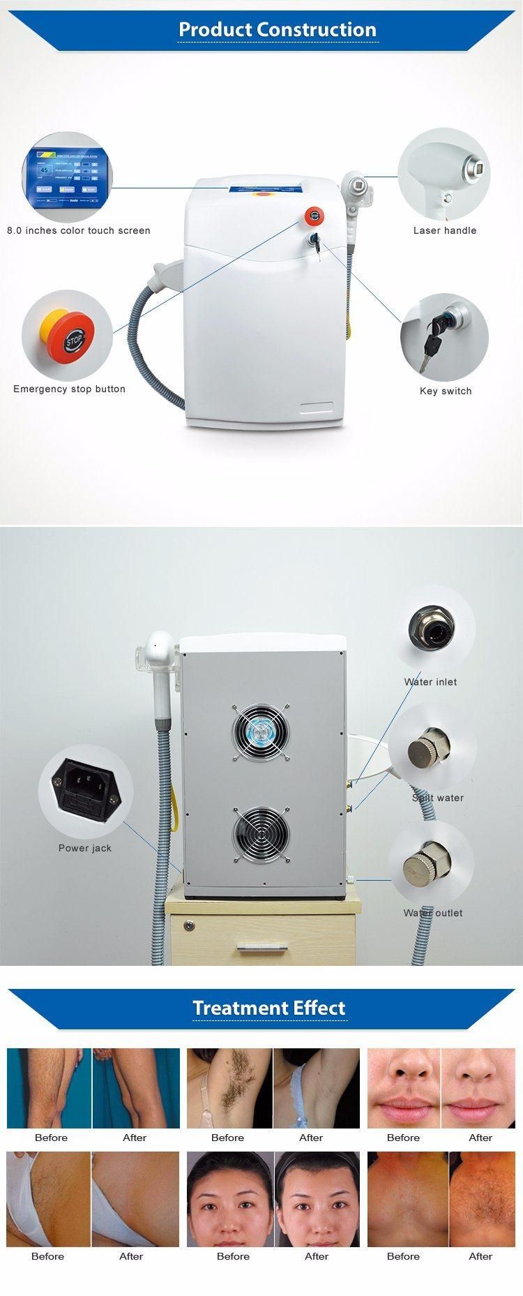 Best Quality Portable 808nm Diode Laser Machine Price