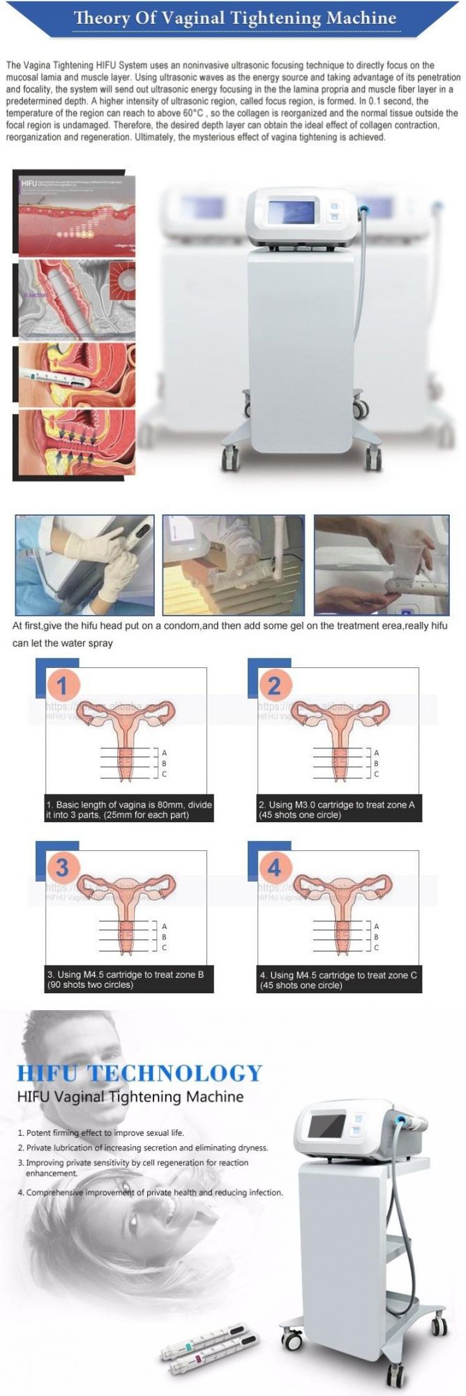 Hifu Doublo Hironic Co Korea Vaginal Tightening Machine