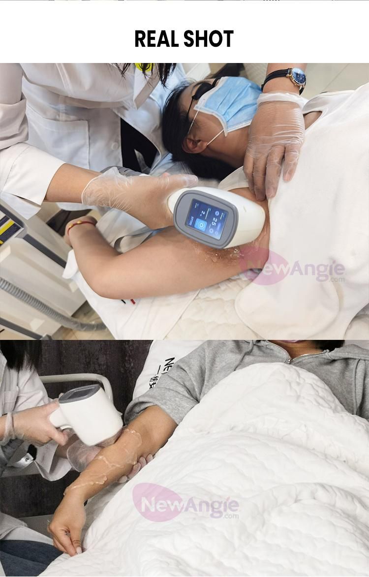Beauty Clinic Skin Rejuvenation 808nm Diode Laser Hair Removal Beauty