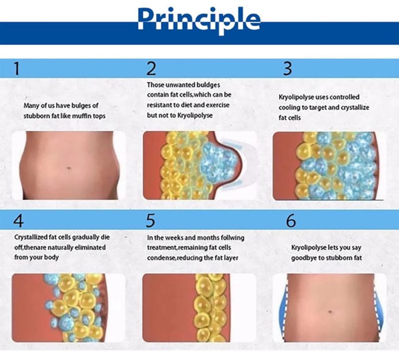 Jo. Fat Lipolysis Cellulite Reduction Double Chin Fat Reduction Coolplas Stubborn Fat Remove Non Invasive No Pain No Surgery No Downtime Machine