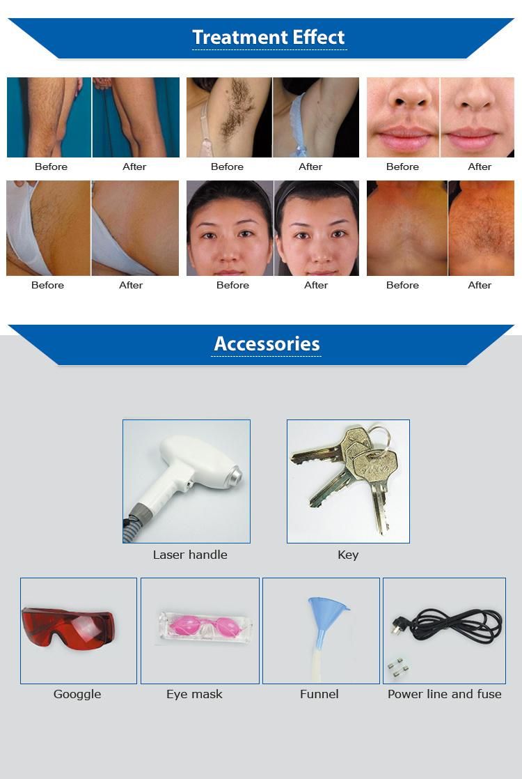 808nm Portable Diode Laser Hair Removal Machine Price