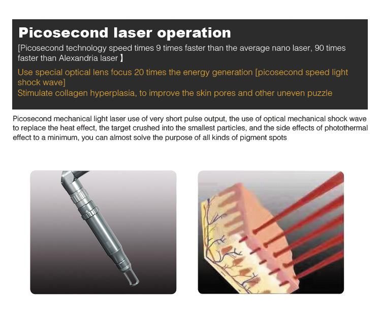 Professional Picosecond Pico 755nm Laser Tattoo Removal Machine