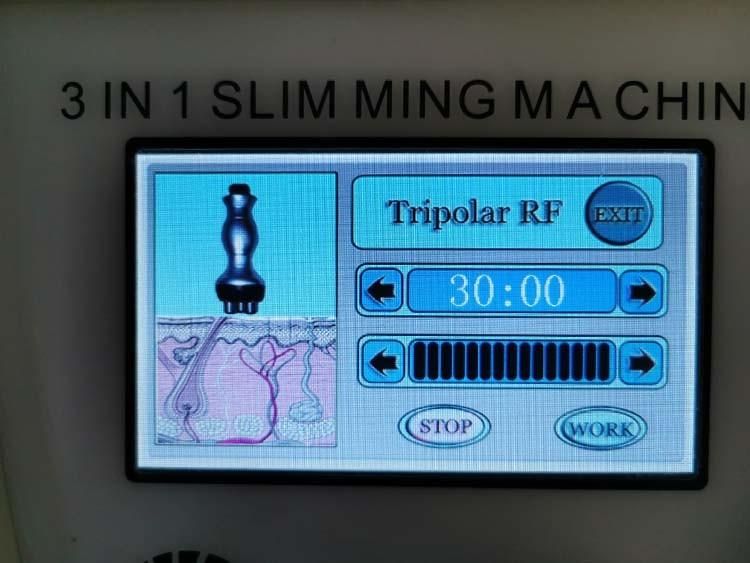 Weight Loss RF Vacuum 40K Cavitation Beauty Machine for Body Slimming System (S04)