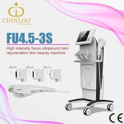 Hifu Portable Focused Ultrasound Beauty Machine for Skin Tightening (Fu4.5-3s)
