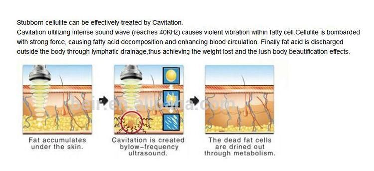 Ultrasonic Radio Frequency Cavitation / Radiofrequenza Cavitazione Lipo Laser Treatment Beauty Machine for Cellulite Removal Body Contouring