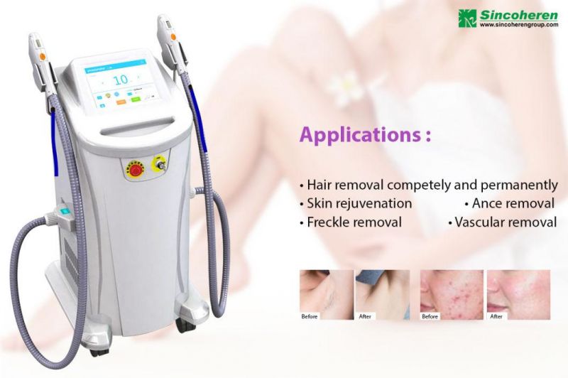 2 Handles IPL Laser Hair Removal Machine for Skin Care Skin Rejuvenation Mutifunction Attract Clients for New Open Clinic
